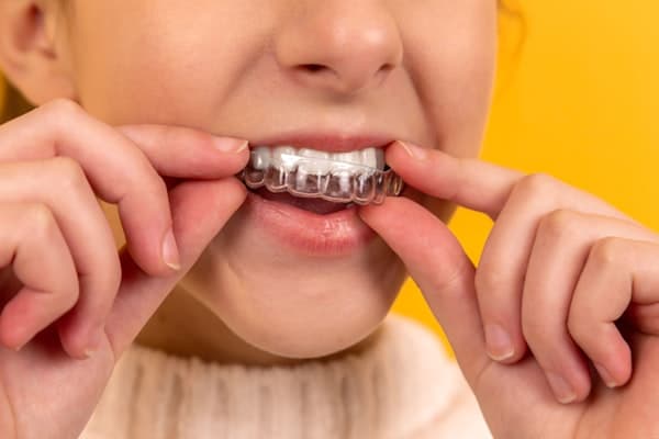 Dental implant